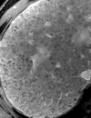 Figure 11b