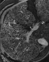 Figure 12d