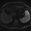 Figure 16f