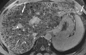 Figure 13b