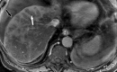 Figure 14a