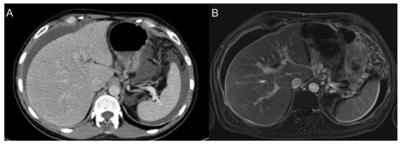 Figure 14