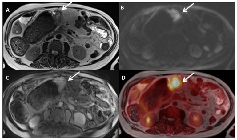 Figure 16