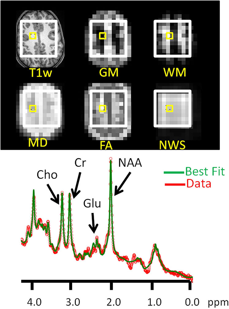 Fig. 2