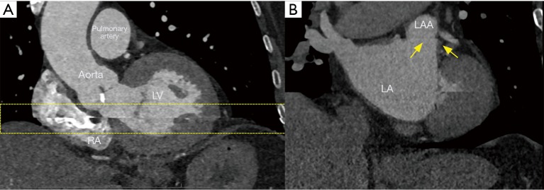 Figure 15