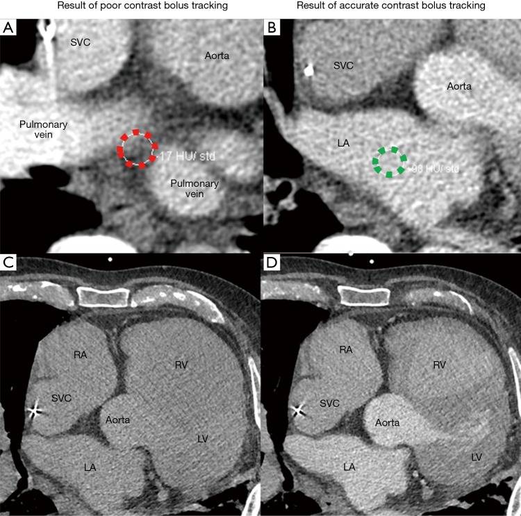 Figure 14