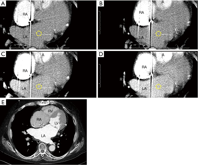 Figure 13