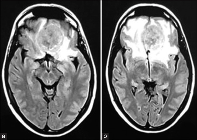 Figure 2: