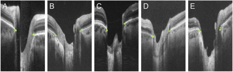 Fig. 5.