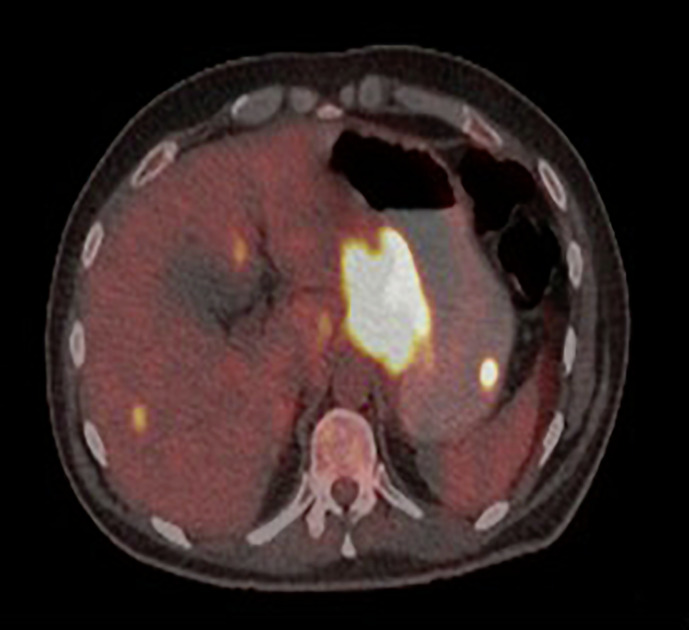 Fig. 5.
