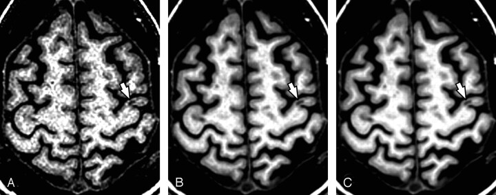 Fig 3.