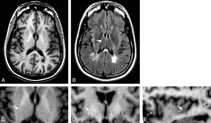 Fig 2.