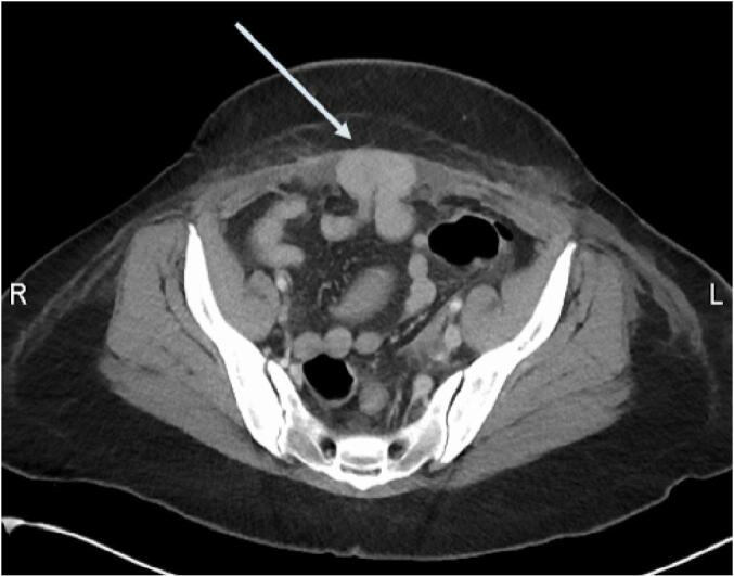 Fig. 1