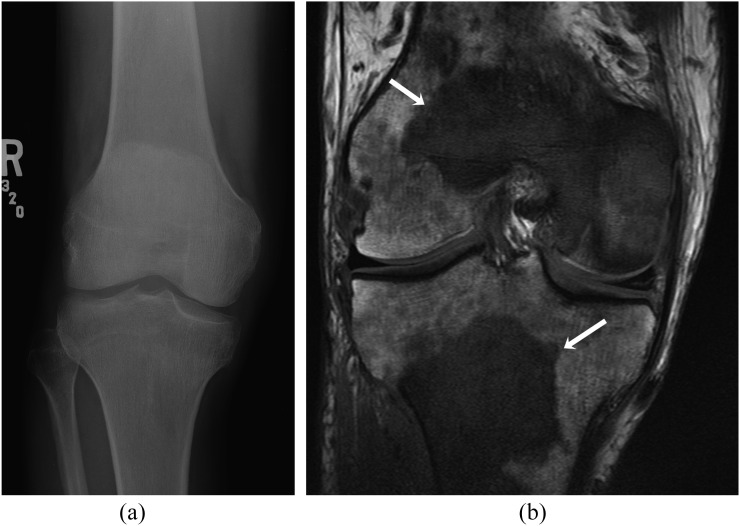 Figure 11.