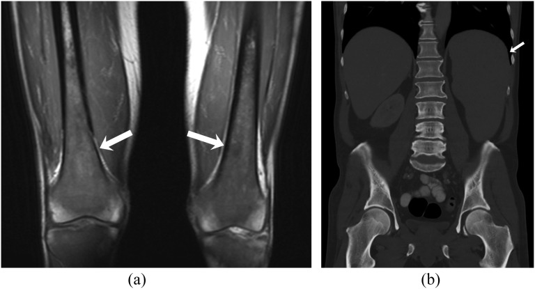 Figure 12.