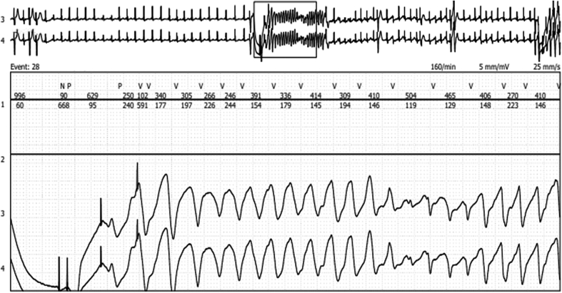 Figure 1