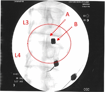 Fig. 1