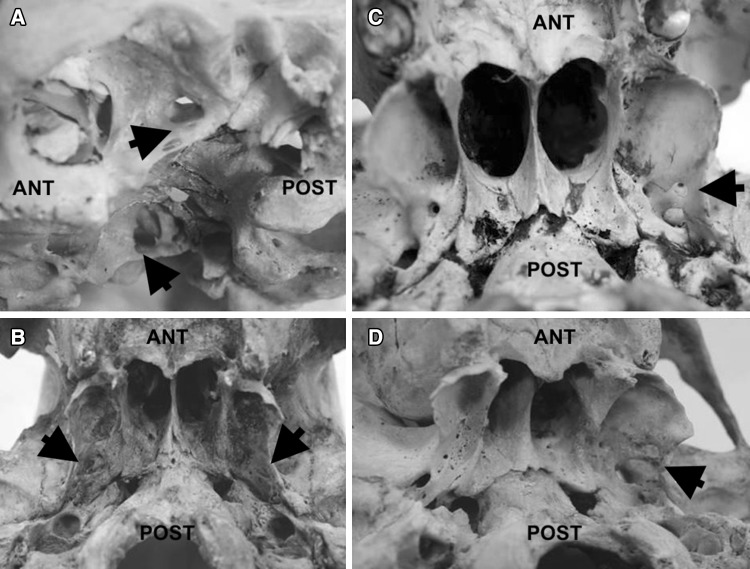 Fig. 2