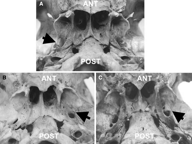 Fig. 3