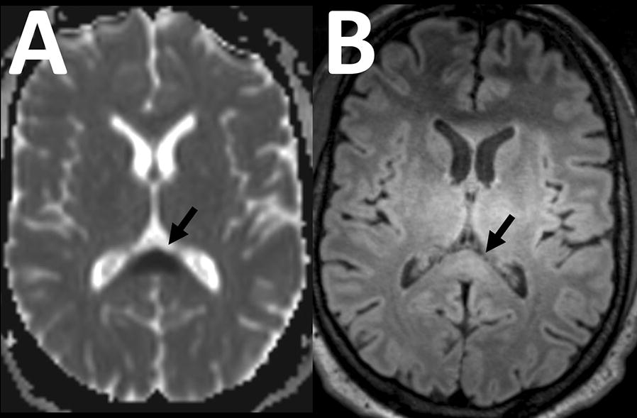 Fig. 1