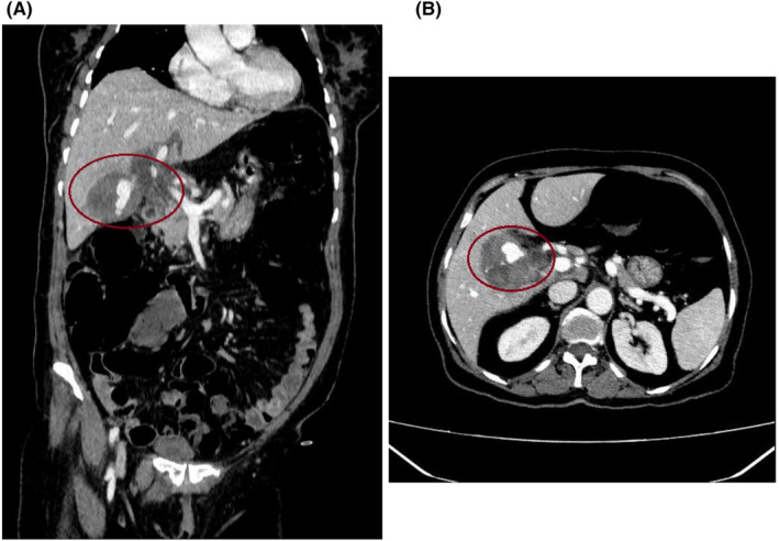 FIGURE 1