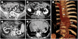 Fig. 10