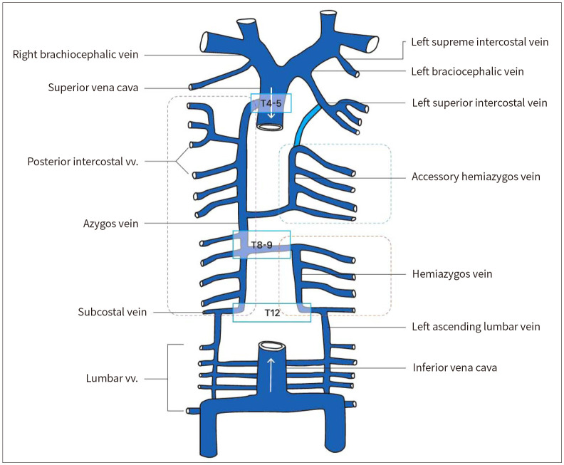 CT Findings of Azygos Venous System: Congenital Variants and Acquired ...