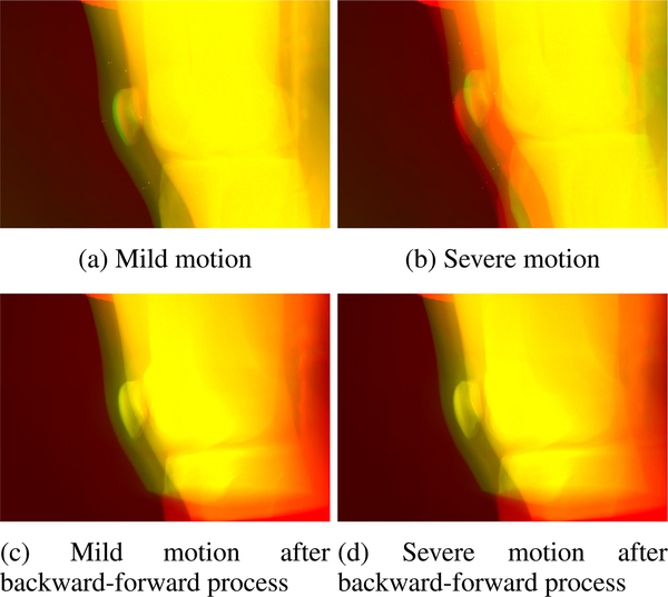 FIGURE 11.