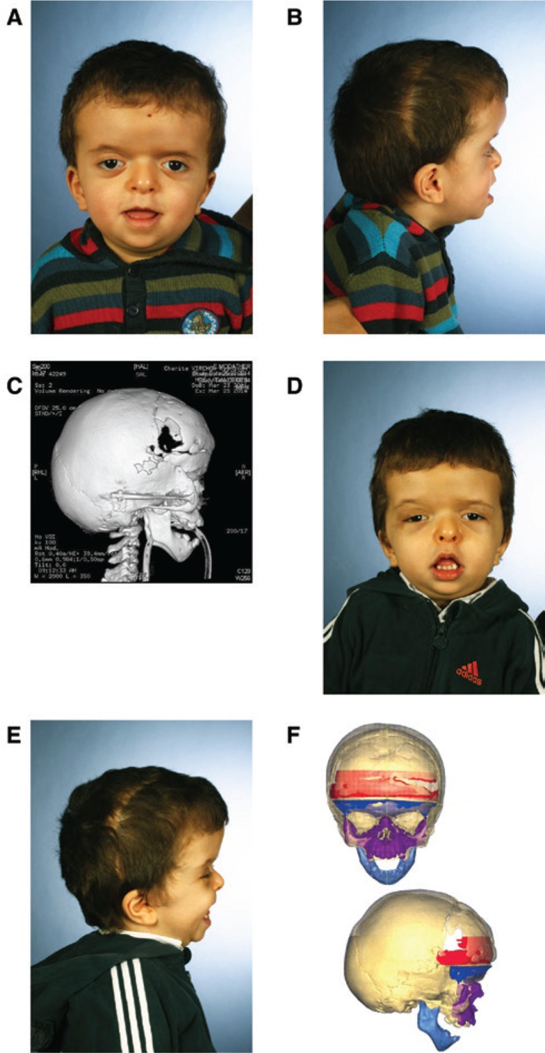 Figure 2: