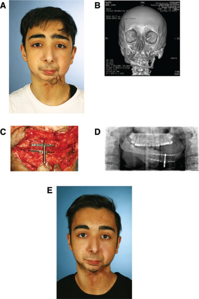 Figure 3: