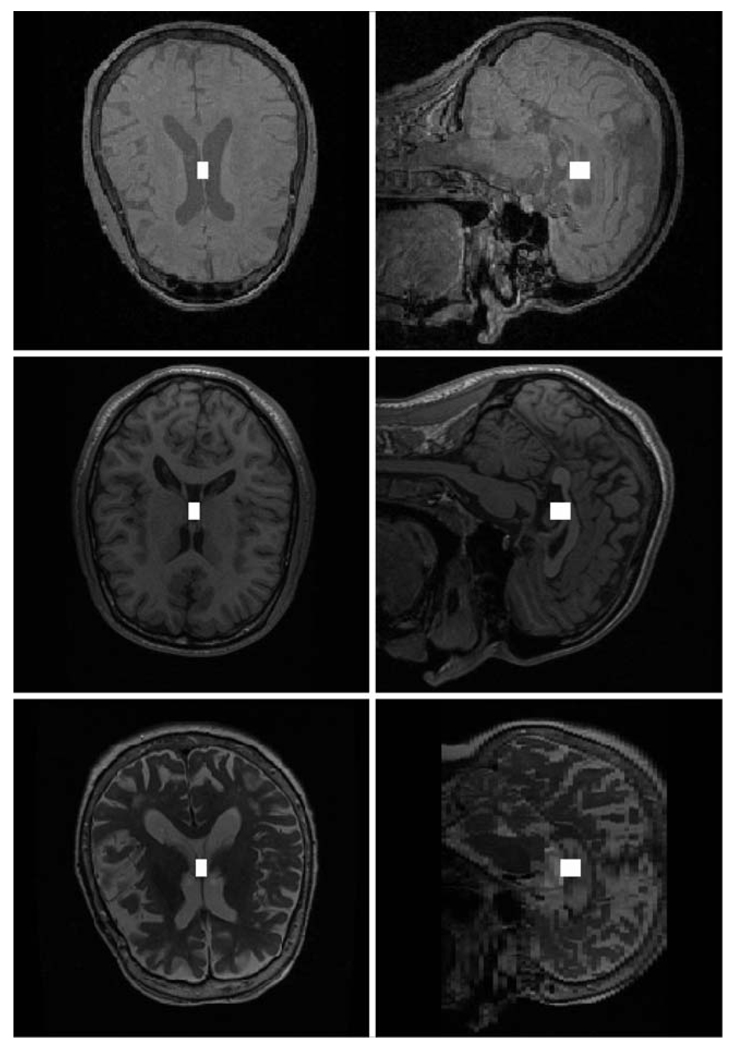 Fig. 13