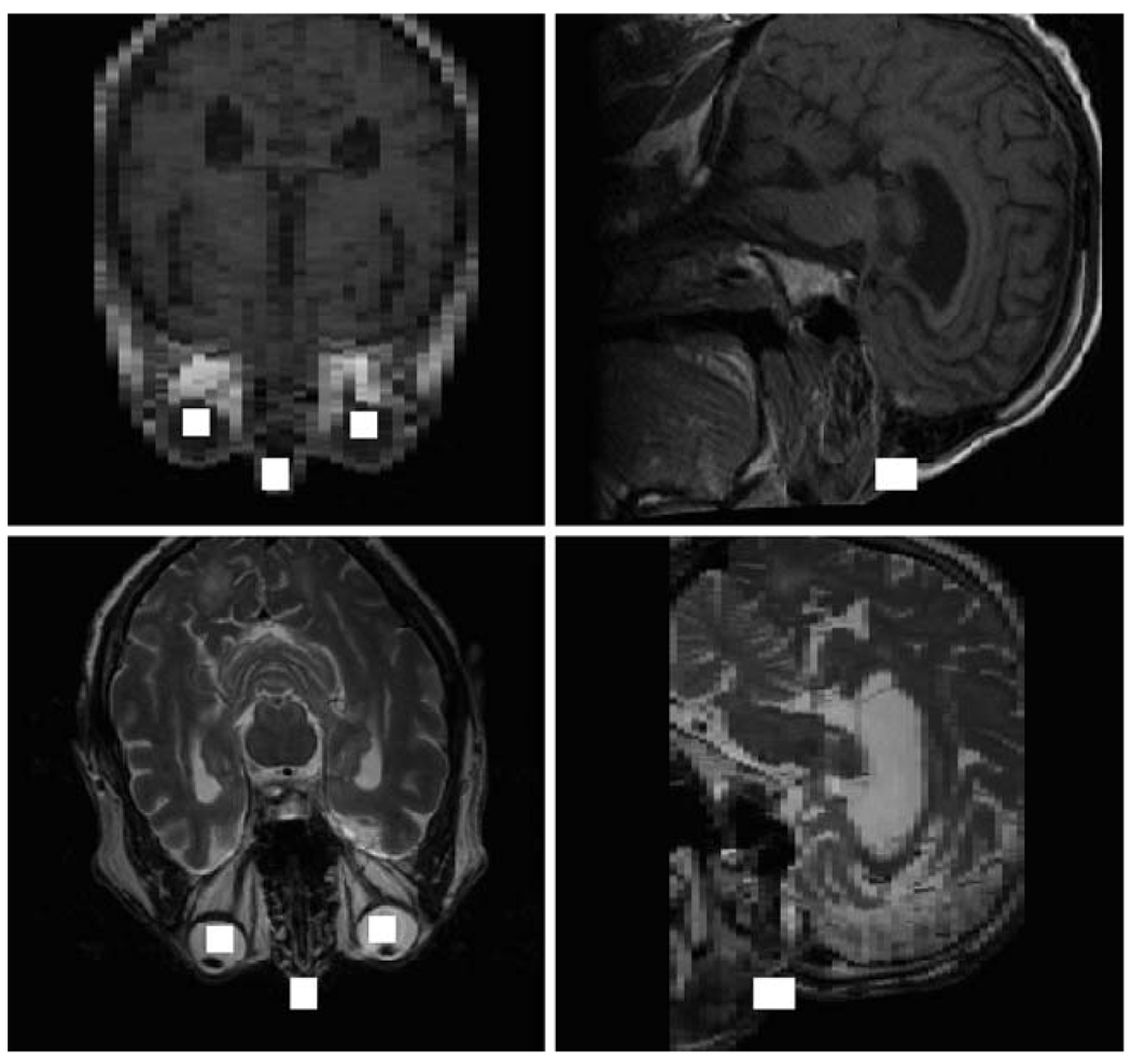 Fig. 11