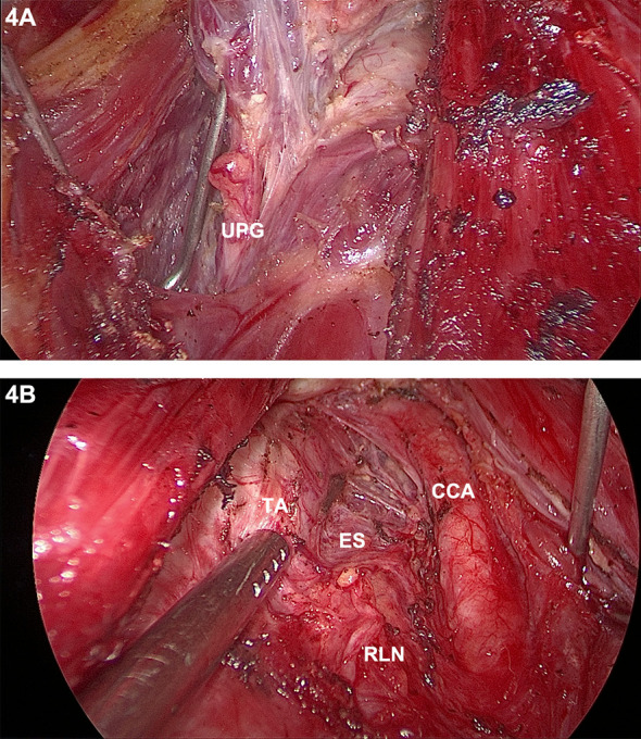 Figure 4