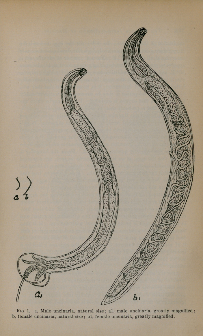 Uncinariasis (Ankylostomiasis); Its Frequency and Importance in the ...