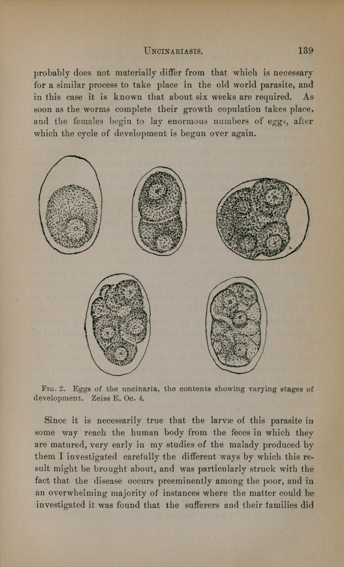 Uncinariasis (Ankylostomiasis); Its Frequency and Importance in the ...