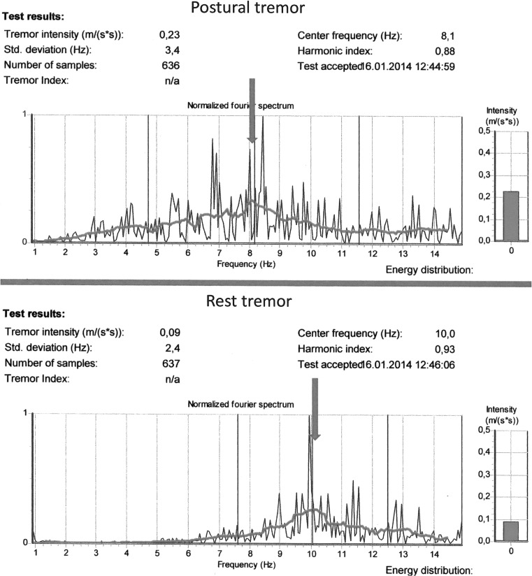 Fig. 2