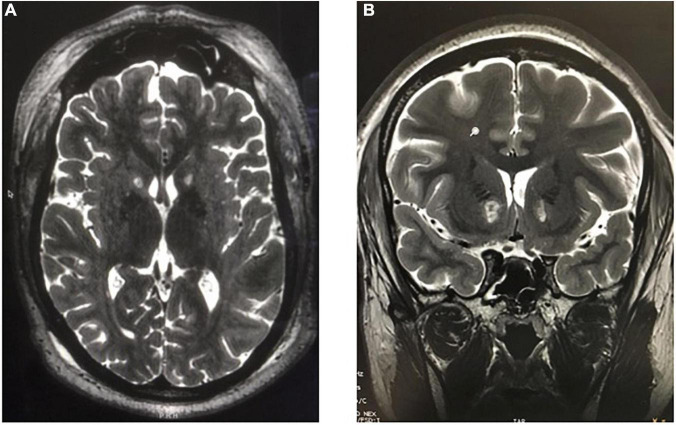 FIGURE 11