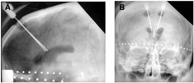 FIGURE 3