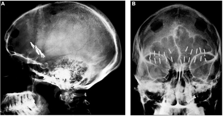 FIGURE 1