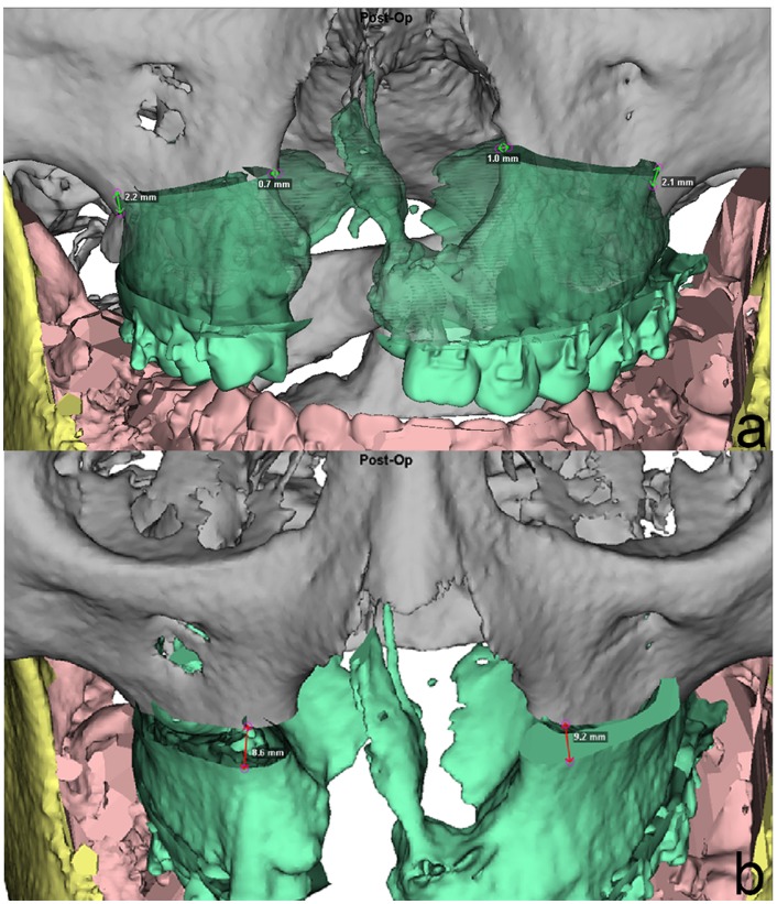 Fig 8