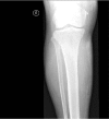 Figure 2a