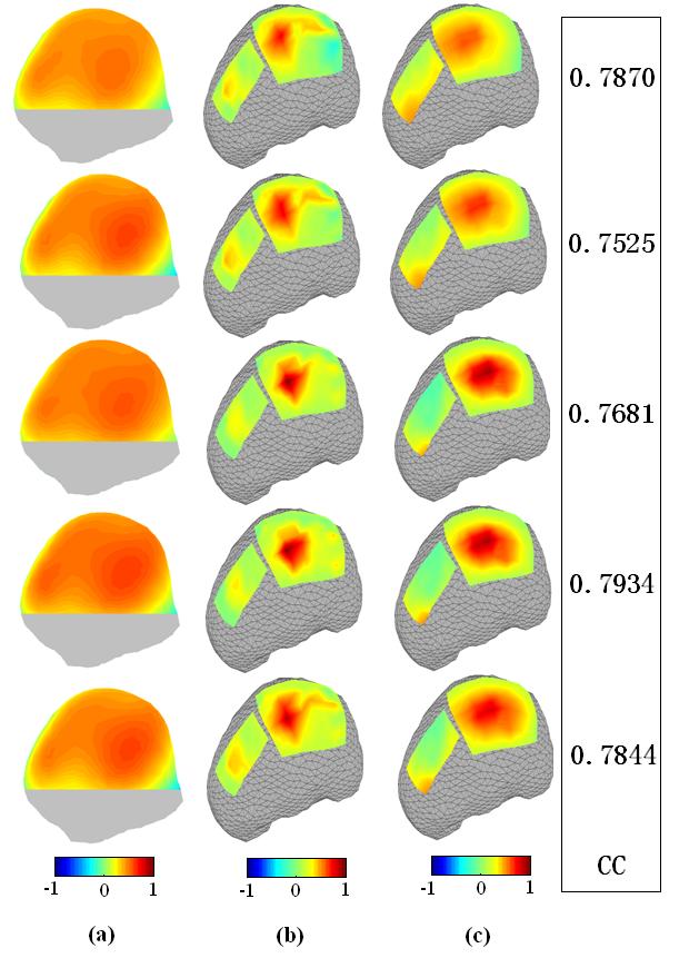 Fig. 11