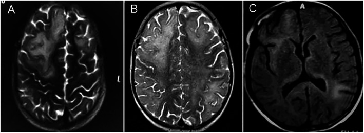 FIG. 1