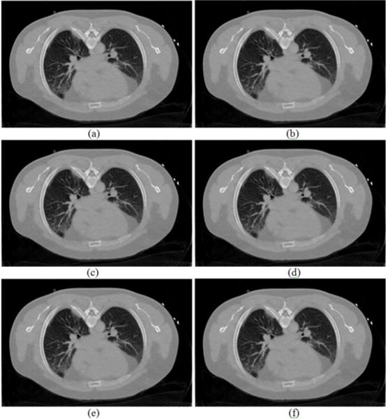 FIG. 6