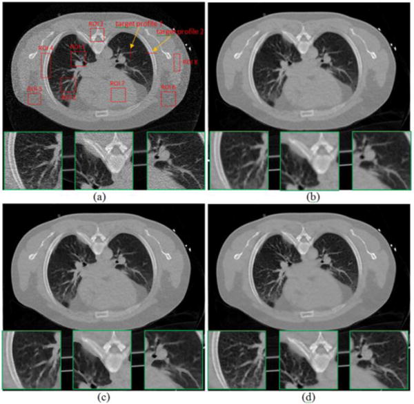 FIG. 5