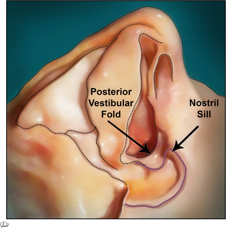 Fig. 14