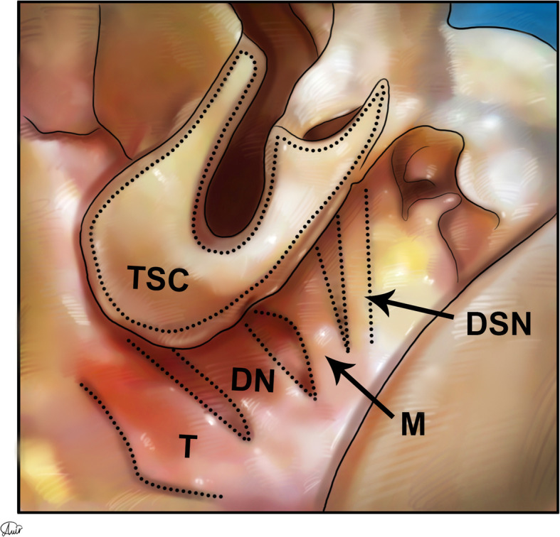 Fig. 13