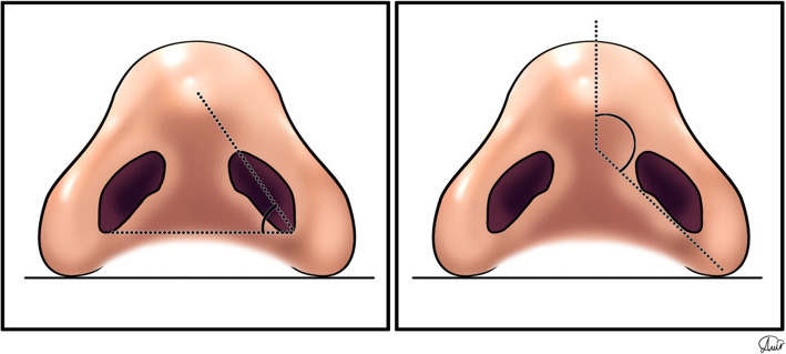 Fig. 11