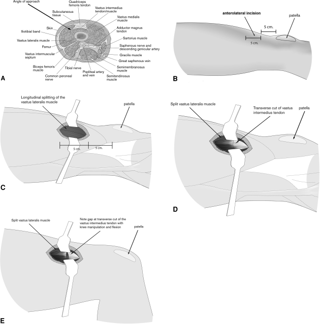 Fig. 1A–E