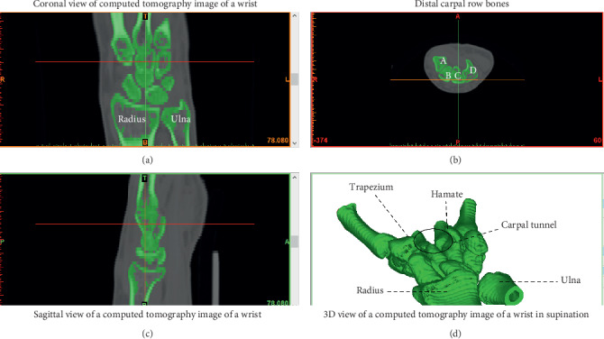 Figure 2